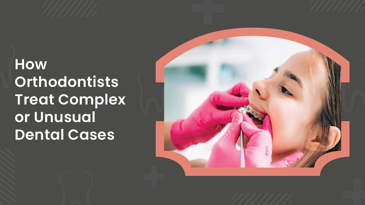 How Orthodontists Treat Complex or Unusual Dental Cases